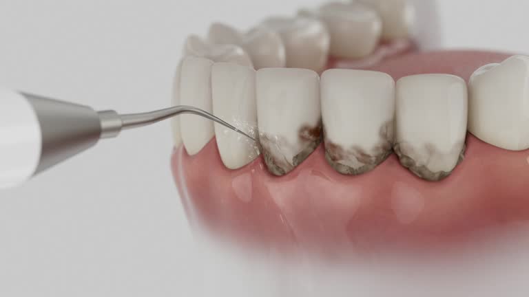 Reliable Tooth Extraction contractor in Livingston Parish County, LA by Dentist Open Now